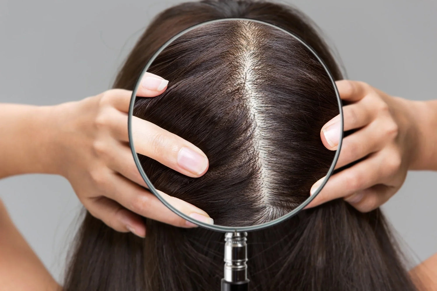 What Your Scalp Microbiome Says About Your Hair — And How Probiotics Help Fix It